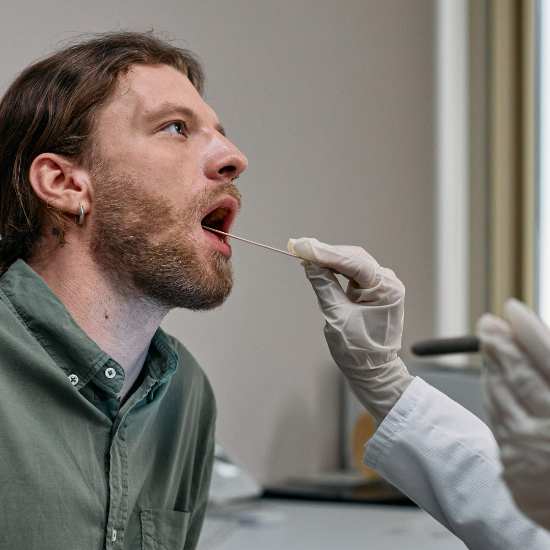 Neuer Speicheltest zur Diagnose von Mund- und Kehlkopfkrebs