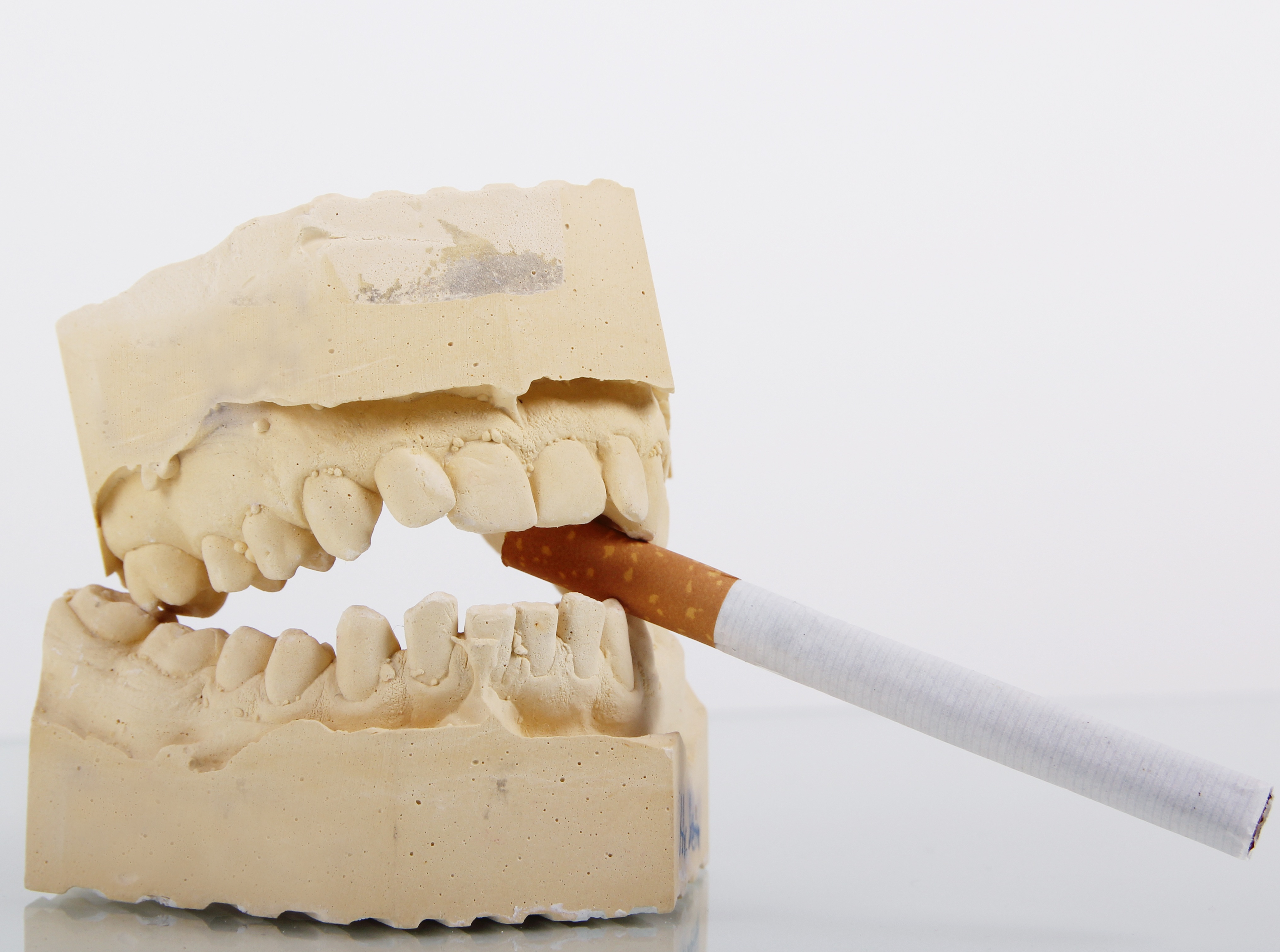 Im Vergleich: Zahnverfärbungen bei Rauchern und Nichtrauchern