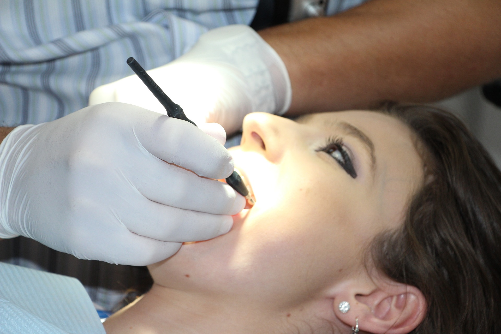 Welche gesetzlichen Kassen bezuschussen die professionelle Zahnreinigung?